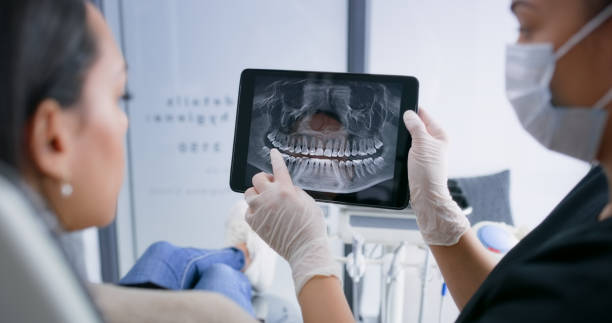 Licensed Teeth Whitening service in Cisco, TX - Smile Center Dentistry